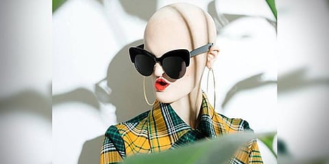 விசித்திர நோயால் தாக்கப்பட்ட பெண் மாடலிங்கில் சாதனை