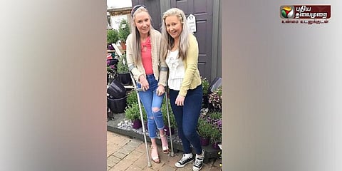 அரிதான நோயால் கல்லாக மாறிவரும் இரட்டையர்கள்