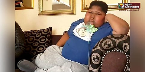 பசி அடங்காத விசித்திர நோய்.. பசியால் பேப்பரை உண்ணும் சிறுவன்