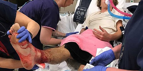 சிறுவனின் கால்களை பதம்பார்த்த மர்மப் பூச்சிகள்!