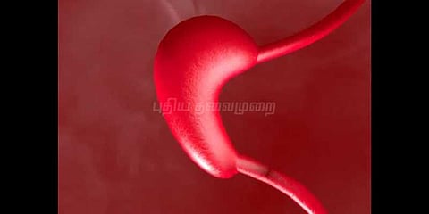 குடல் புண்களை குணப்படுத்த நானோ ரோபோக்கள்