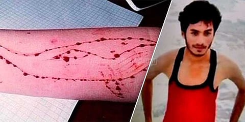 ப்ளூ வேல் விளையாட்டு: மாணவர் தற்கொலை