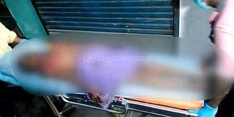 சுயநினைவு திரும்பாத முகம் சிதைக்கப்பட்ட பெண்