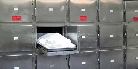 மார்ச்சுவரியில் பெண்ணின் உடலை குதறிய நாய்: அரசு மருத்துவமனையில் அவலம்