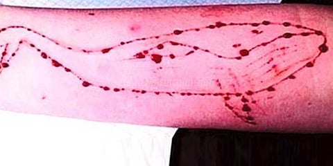 புதுச்சேரியில் ப்ளூவேல் கேம் விளையாடிய இளம்பெண் மீட்பு