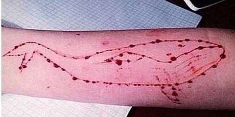 தொடரும் ப்ளூவேல் விபரீதம்: மாடியிலிருந்து குதித்த கல்லூரி மாணவன்