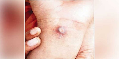 பாலியல் தொழிலாளியாக விற்கப்பட்ட 16 வயது சிறுமி: கர்ப்பிணி அக்காவின் சாதுர்யத்தால் மீட்பு