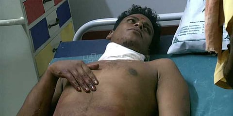 கழுத்தை அறுத்துக் கொண்டு போலீஸாரை மிரட்டிய இளைஞர்