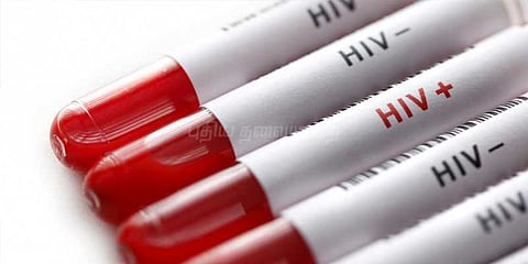 எய்ட்ஸ் நோய்க்கு மருந்து கண்டுபிடிப்பு