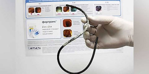 17 ஆண்டுகளாக வயிற்றில் 12 இன்ச் ரப்பர் குழாயுடன் வாழ்ந்த பெண்!!!