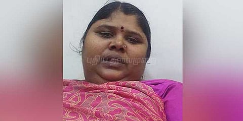பருமன் சிகிச்சையில் பெண் உயிரிழந்த விவகாரம்: மருத்துவர்களிடம் நாளை விசாரணை