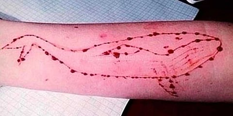 ப்ளூ வேல் பயங்கரம் : இளைஞர் தற்கொலை முயற்சி