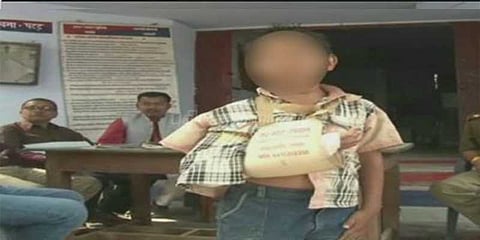 தூக்கத்தை கெடுத்ததால் 2ஆம் வகுப்பு மாணவன் கையை உடைத்த ஆசிரியர்!