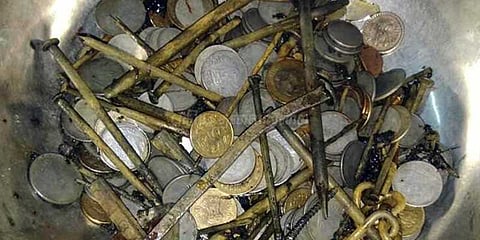 மனிதனின் வயிற்றுக்குள் 263 ரூபாய் நாணயங்கள், பிளேடு, ஊசி: டாக்டர்கள் ஷாக்!