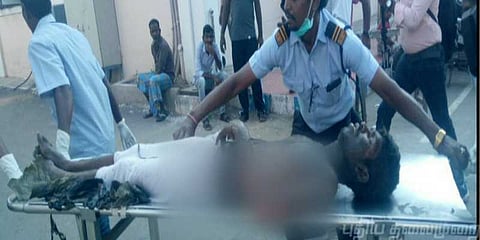 நடுரோட்டில் தீக்குளித்த ஓட்டுநர் மணிகண்டன் மரணம்