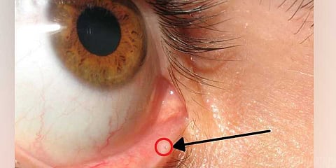 கண்கள் அழும்போது மூக்கிலும் நீர் வெளியாவது ஏன்..?