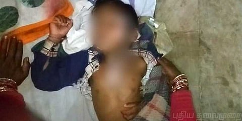 மாணவர் முகத்தில் சூடான குழம்பை ஊற்றிய சமையல்காரர்..!