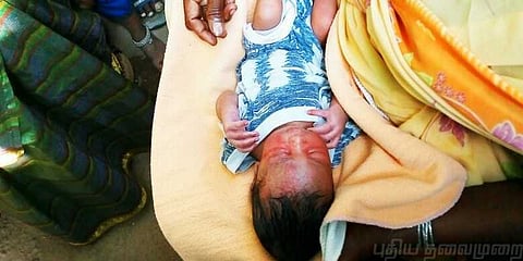பிறந்து சில மணி நேரத்தில் முட்புதரில் வீசப்பட்ட ஆண் குழந்தை..!