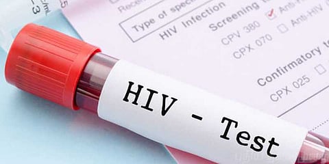 ஹெச்ஐவி-யால் அதிகளவிலான இளைஞர்கள் பாதிப்பு: அதிர்ச்சித் தகவல்!