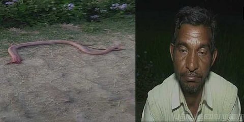 பாம்பை கடித்து கொன்ற உ.பி.க்காரர்... மெடிக்கல் மிராக்கிள் என மருத்துவர் கருத்து