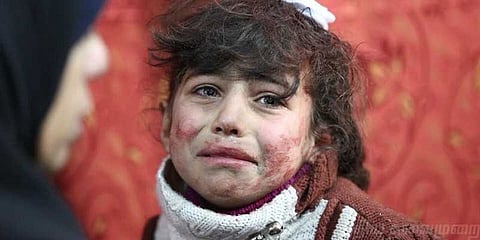 சிரியா அரசுப் படை தாக்குதல்: கண்ணீரை வரவழைக்கும் அப்பாவி குழந்தைகளின் மரணம்