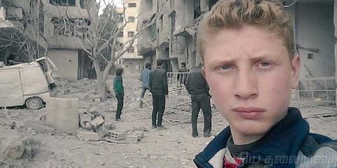 போர் அடித்துவிட்டதா எங்கள் காயங்கள் ? : வைரலாகும் சிரியா சிறுவனின் செல்ஃபி வீடியோ