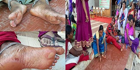 ‘செருப்பின்றி ஓடச் சொன்னார்கள்’: பாதம் புண்பட்ட பெண் ஊழியர்கள்!