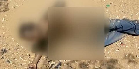 மனைவியின் பணி நிரந்தரத்துக்காக தீக்குளித்த கணவர்!