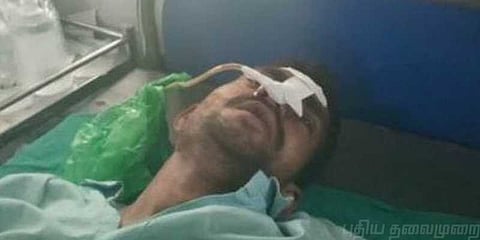 மந்திரவாதியின் ஷாக் ட்ரீட்மென்ட்: பேட்டரி, சாவி, ஊசிகளை தின்ற இளைஞருக்கு ஆபரேஷன்!