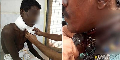 கம்பிகளை கழுத்தில் சுற்றும் விநோத மனிதன்: மீட்டெடுத்த அறக்கட்டளை