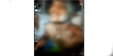 காதல் விவகாரத்தில் இளைஞர் தீக்குளிப்பு: பெண்ணின் தந்தை மீது வழக்குப்பதிவு