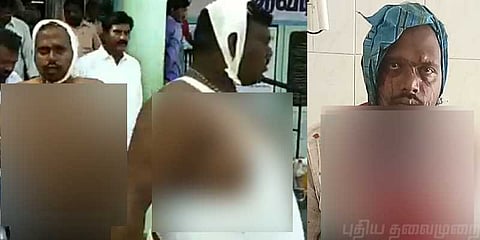 கோழி வாங்க பேரம் பேசிய இளைஞர்கள் - அரிவாளால் வெட்டிய பெண்