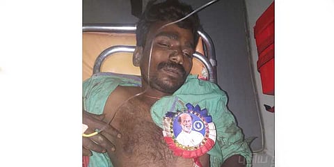 ரஜினி ரசிகரின் கால் துண்டான பரிதாபம் !