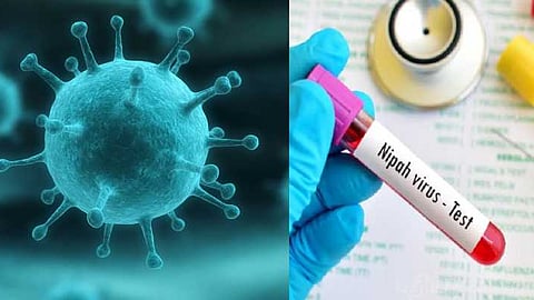 நிபா வைரஸ்