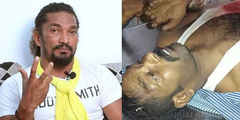 ஸ்டண்ட் மாஸ்டர் சில்வாவின் உறவினர் தூத்துக்குடி துப்பாக்கிச் சூட்டில் பலி