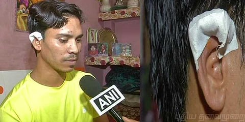 குடித்துவிட்டு போதையில் காதை கடித்து விழுங்கிய ஆசாமி !