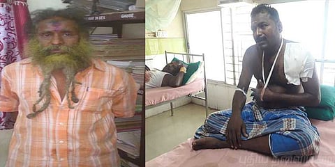 வேலூர் அருகே ஓட்டுநர் மற்றும் நடத்துநருக்கு கத்திக்குத்து