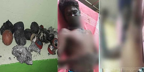 தயாரிக்கும் போது வெடித்த நாட்டு வெடிகுண்டு : இருவர் படுகாயம்