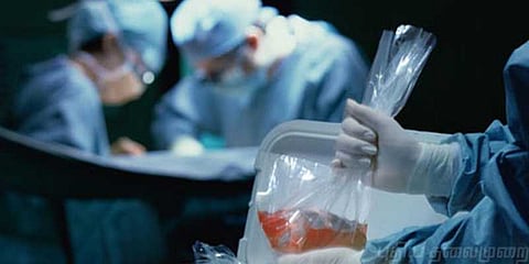 உடல் உறுப்பு மாற்றத்திலும் ஊழல் செய்யும் தமிழ்நாடு ? வெளிவரும் அதிர்ச்சி உண்மைகள்