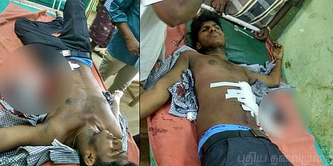 ஃபேஸ்புக் காதல்; பெண் வீட்டின் முன் வயிற்றில் கத்தியால் குத்திக்கொண்ட இளைஞன்