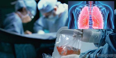 ஒரு நுரையீரல் 1 கோடியே 80 லட்சம் ரூபாய்: அம்பலமான மருத்துவ உலக மாஃபியா வியாபாரம்