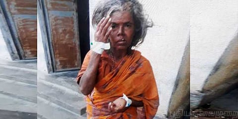 தெலுங்கில் பேசிய மூதாட்டி - குழந்தை கடத்த வந்ததாக தாக்குதல்