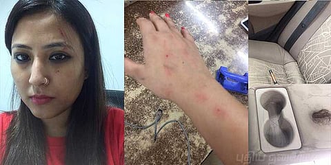 சக பயணி மீது நிறவெறித் தாக்குதல்: மும்பையில் பத்திரிகையாளருக்கு நேர்ந்த கொடுமை