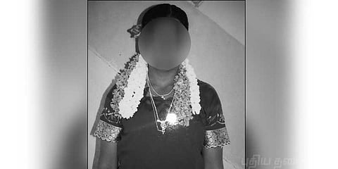 கல்லூரி தேர்வில் தோல்வியடைந்ததால் தீக்குளித்த மாணவி !