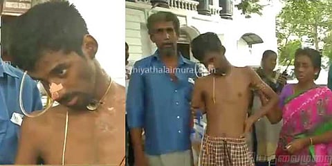 காசநோய்க்கு பதில் புற்றுநோய்க்கு சிகிச்சை அளித்த மருத்துவர்கள்! உயிருக்கு போராடும் இளைஞர்