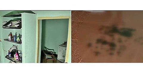 மருத்துவக் கல்லூரி மாணவர் தற்கொலை