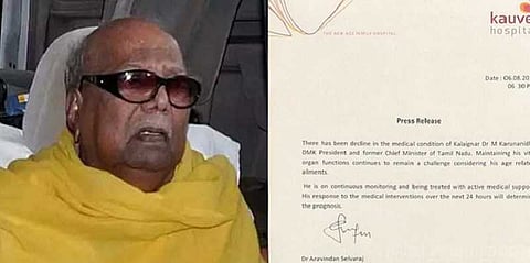 கருணாநிதி உடல்நிலை மிகவும் கவலைக்கிடம் - மருத்துவமனை அறிக்கை