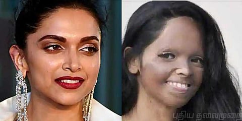 ஆசிட் தாக்குதலில் பாதிக்கப்பட்ட பெண்ணின் கதையில் தீபிகா!