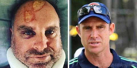 அலைச்சறுக்கில் விபத்து: முன்னாள் கிரிக்கெட் வீரர் மேத்யூ ஹைடன் படுகாயம்