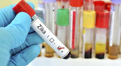 ராஜஸ்தானில் 22 பேருக்கு ஜிகா வைரஸ் பாதிப்பு